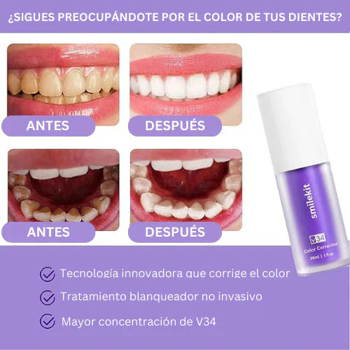 Blanqueador Dental V34™ - TRENDFINDER® (2024) ⭐⭐⭐⭐⭐